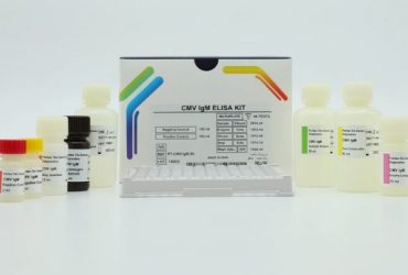 کیت CMV IgM پیشتاز