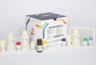 کیت HSV IgG پیشتاز طب